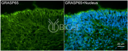 GRASP65 (GORASP1) Antibody - FFPE Validated