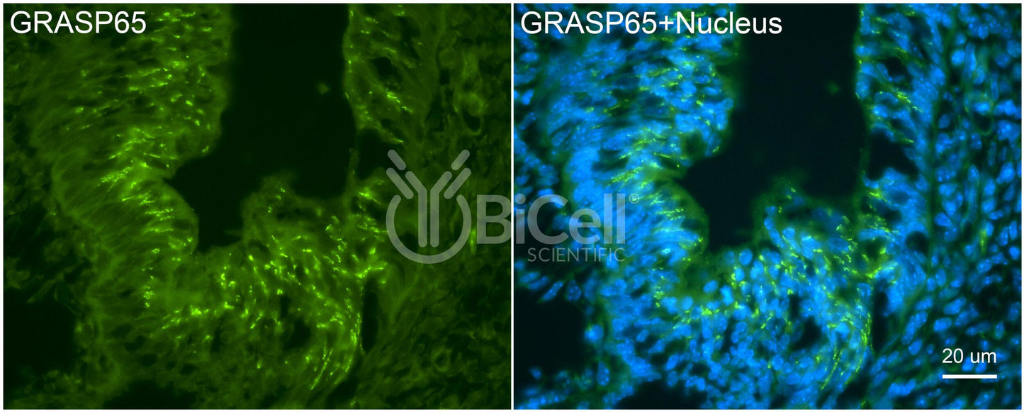 GRASP65 (GORASP1) Antibody - FFPE Validated