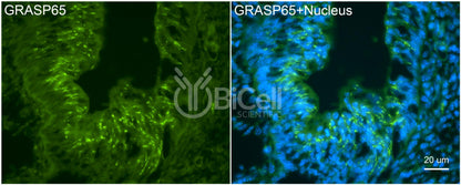 GRASP65 (GORASP1) Antibody - FFPE Validated