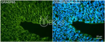 GRASP65 (GORASP1) Antibody - FFPE Validated