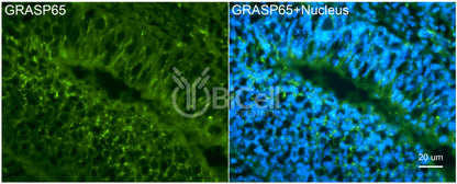 GRASP65 (GORASP1) Antibody - FFPE Validated