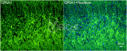 GRIA1 (GluR1 or GluA1) Antibody - FFPE Validated