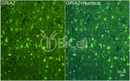 GRIA2 (GluR2 or GluA2) Antibody - Western Blot Validated