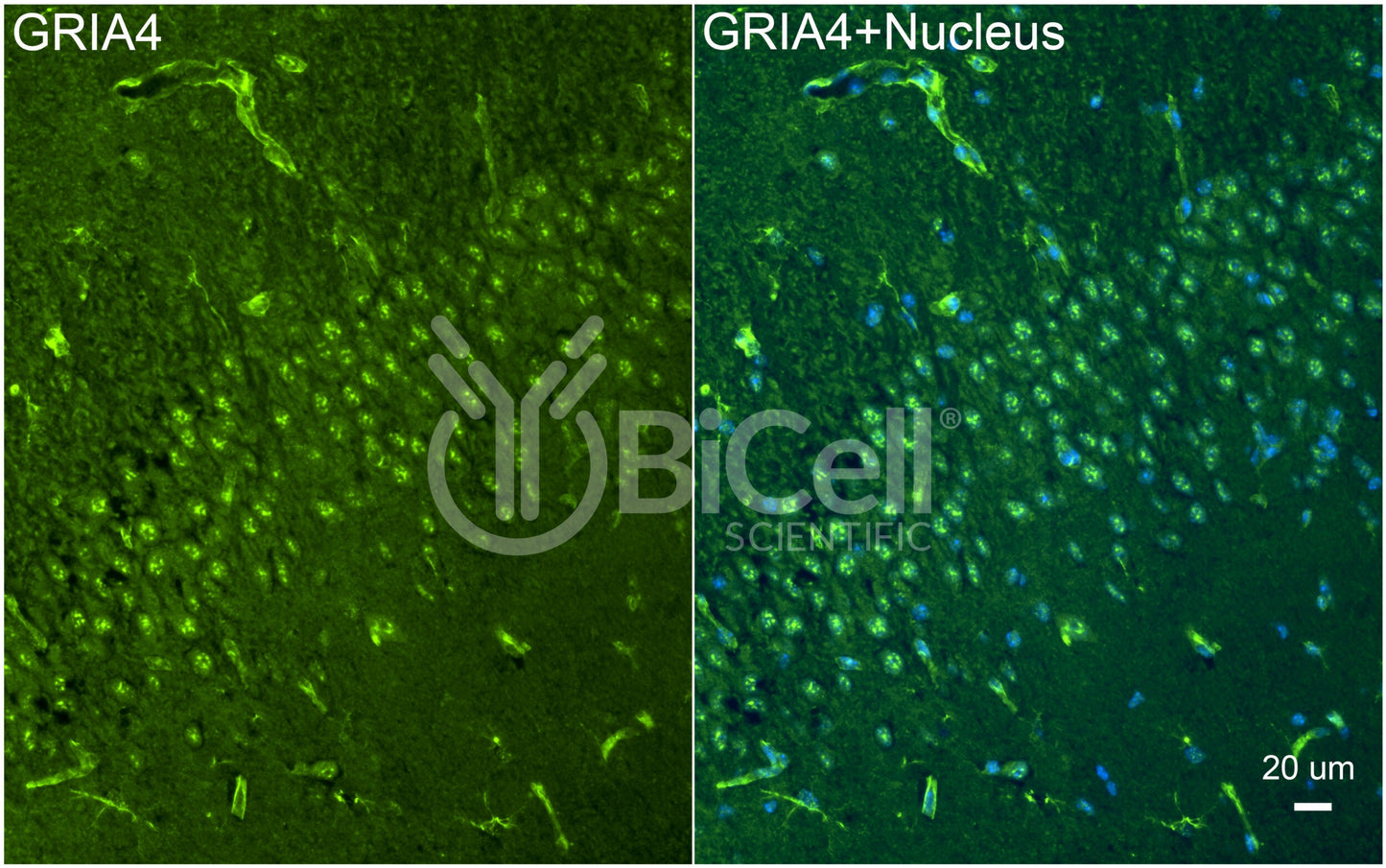 GRIA4 (GluR4 or GluA4) Antibody - FFPE Validated