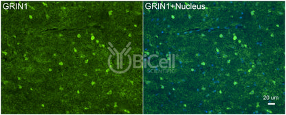 GRIN1 (GluN1) Antibody - Western Blot Validated