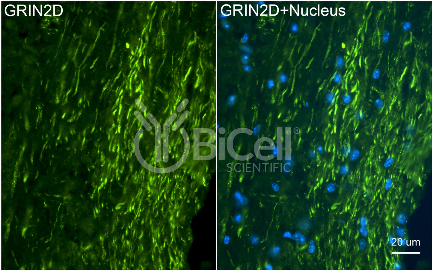GRIN2D (GluN2D) Antibody