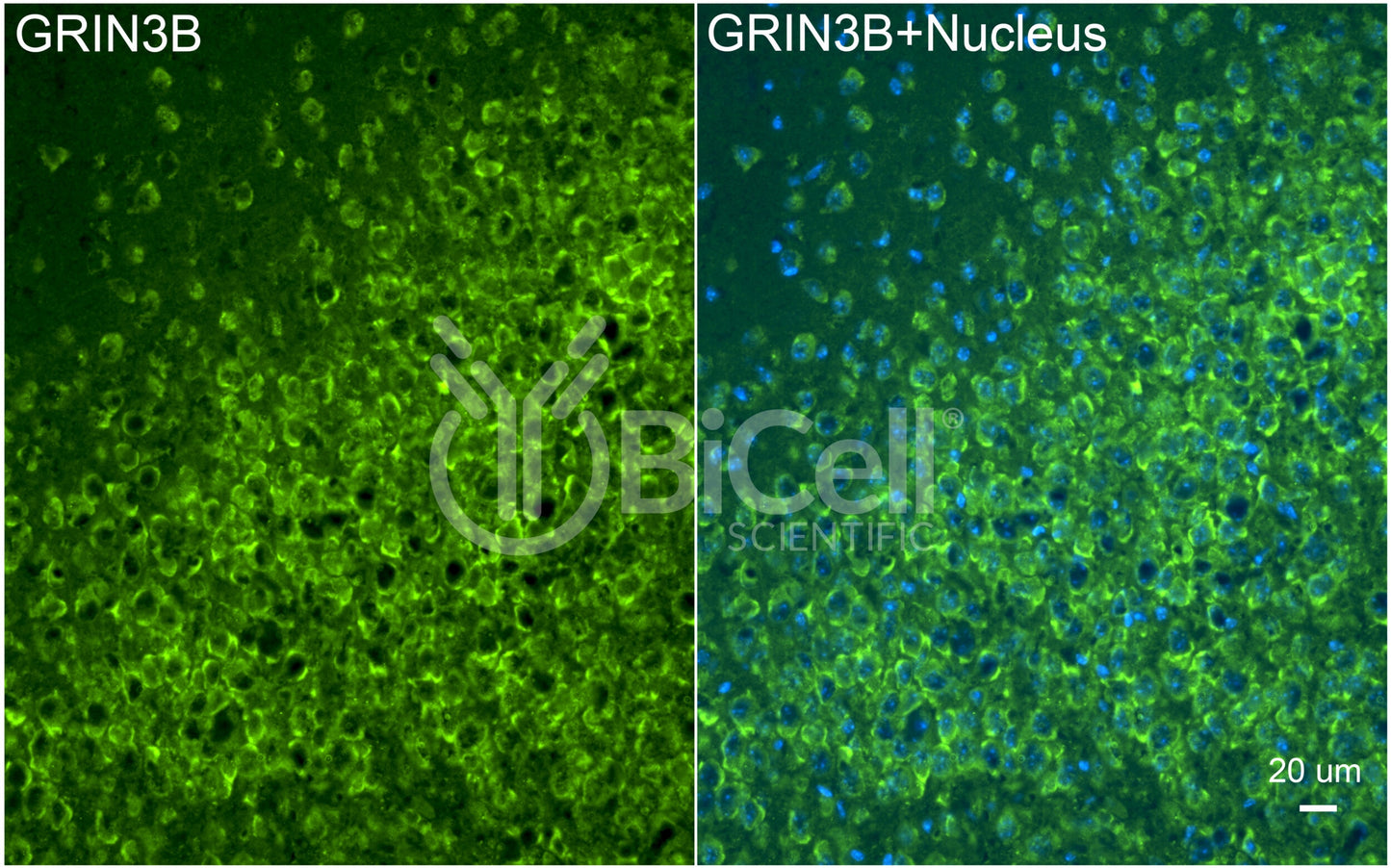GRIN3B (GluN3B) Antibody