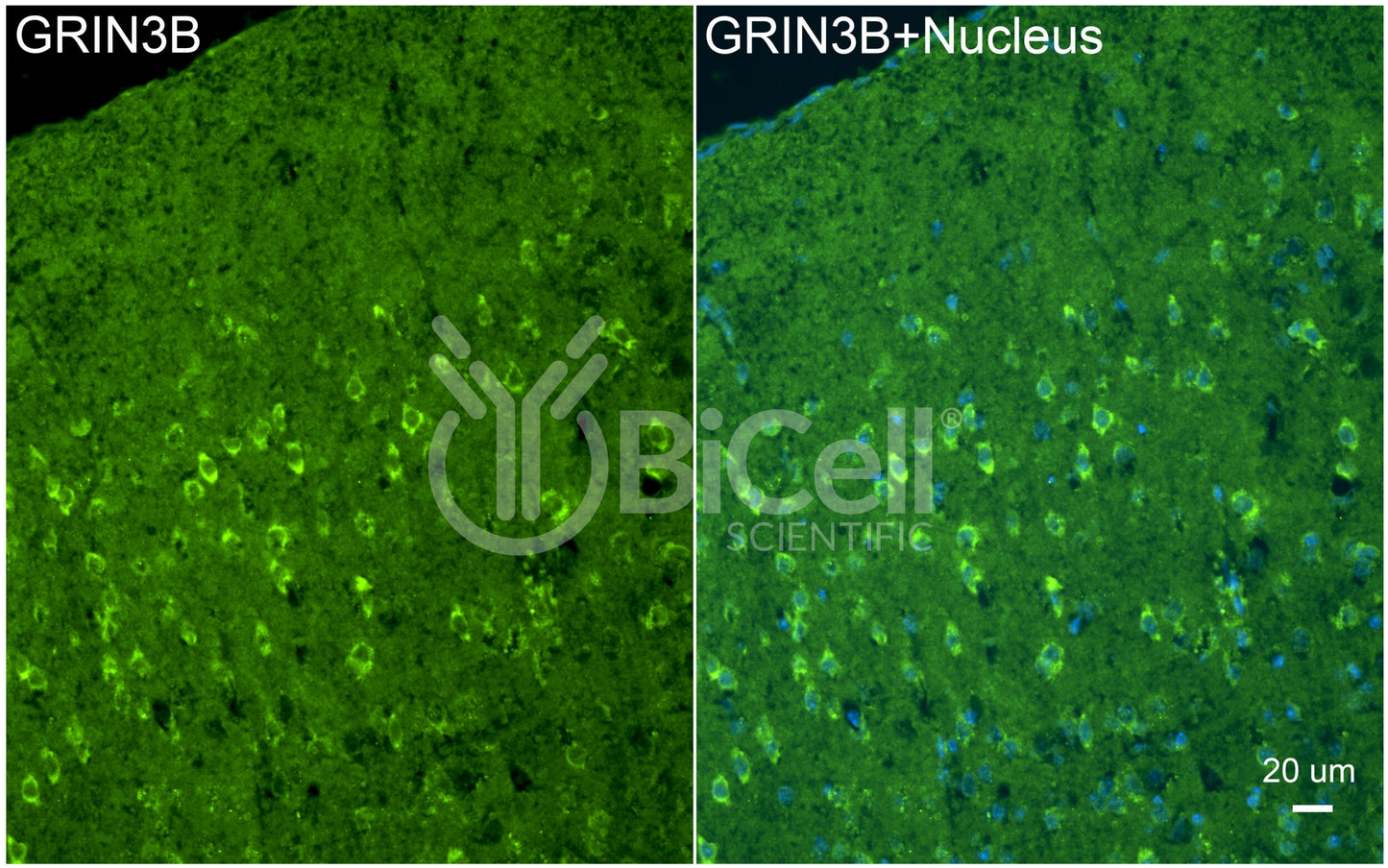 GRIN3B (GluN3B) Antibody