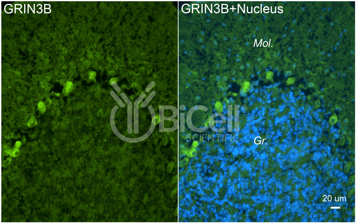 GRIN3B (GluN3B) Antibody