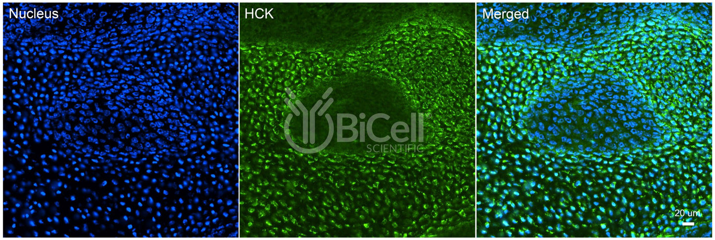 HCK Antibody