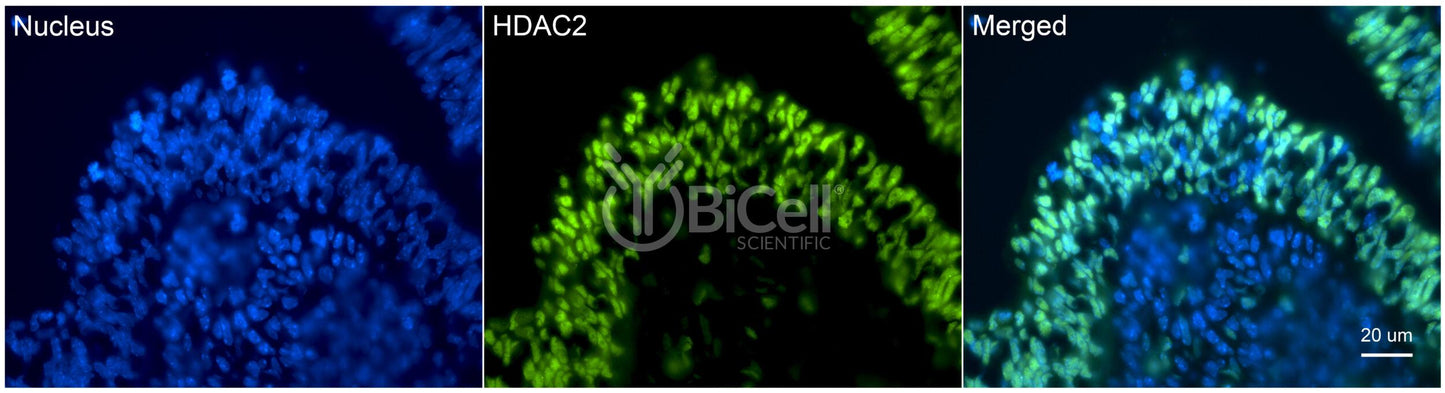 HDAC2 Antibody