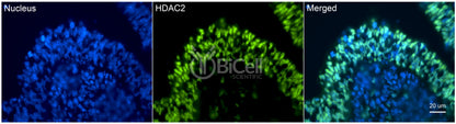 HDAC2 Antibody