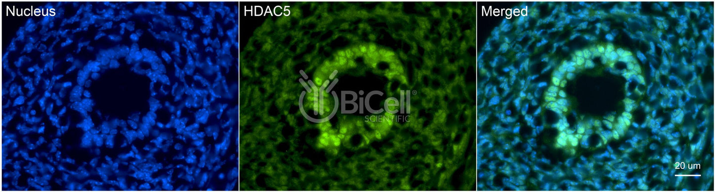 HDAC5 Antibody