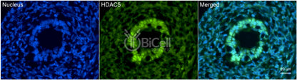 HDAC5 Antibody