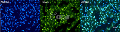 HDAC5 Antibody - Western Blot Validated