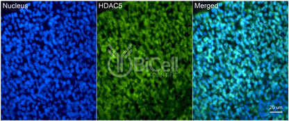 HDAC5 Antibody