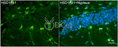 11-beta-HSD1 (HSD11B1) Antibody - FFPE Validated