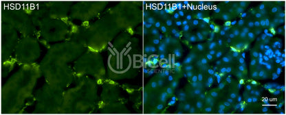 11-beta-HSD1 (HSD11B1) Antibody - FFPE Validated