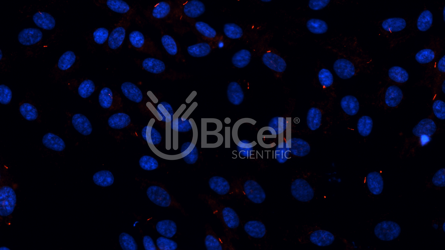 ARL13B (Human) (ARL2L1) HiRe (Rabbit) Antibody - FFPE Validated