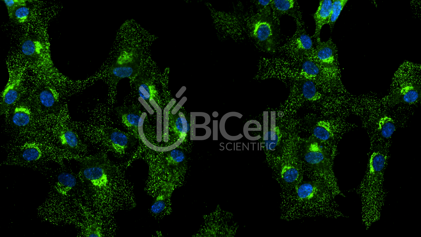 Clathrin Heavy Chain (CLTC) HiRe Antibody - FFPE Validated
