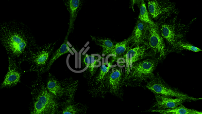 VAMP1 (SYB1) HiRe Antibody - Western Blot Validated