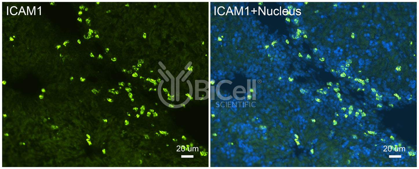 ICAM1 (CD54) Antibody - FFPE Validated