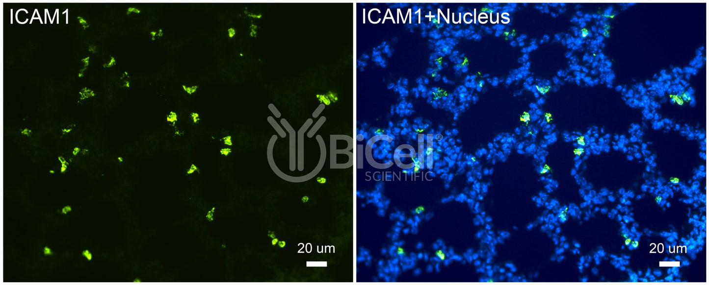 ICAM1 (CD54) Antibody - FFPE Validated