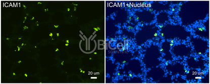 ICAM1 (CD54) Antibody - FFPE Validated