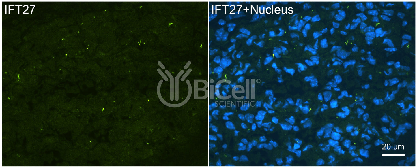 IFT27 (BBS19) Antibody