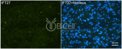 IFT27 (BBS19) Antibody