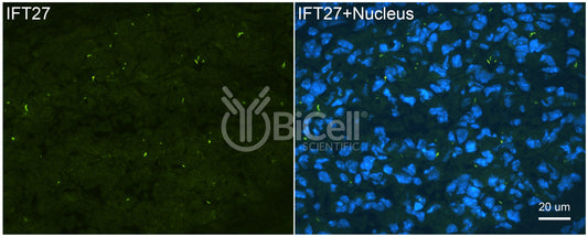 IFT27 (BBS19) Antibody - FFPE Validated