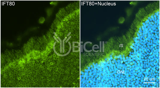 IFT80 Antibody - FFPE Validated