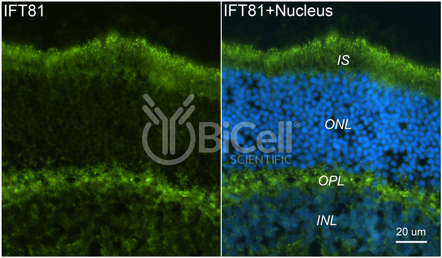 IFT81 Antibody - FFPE Validated