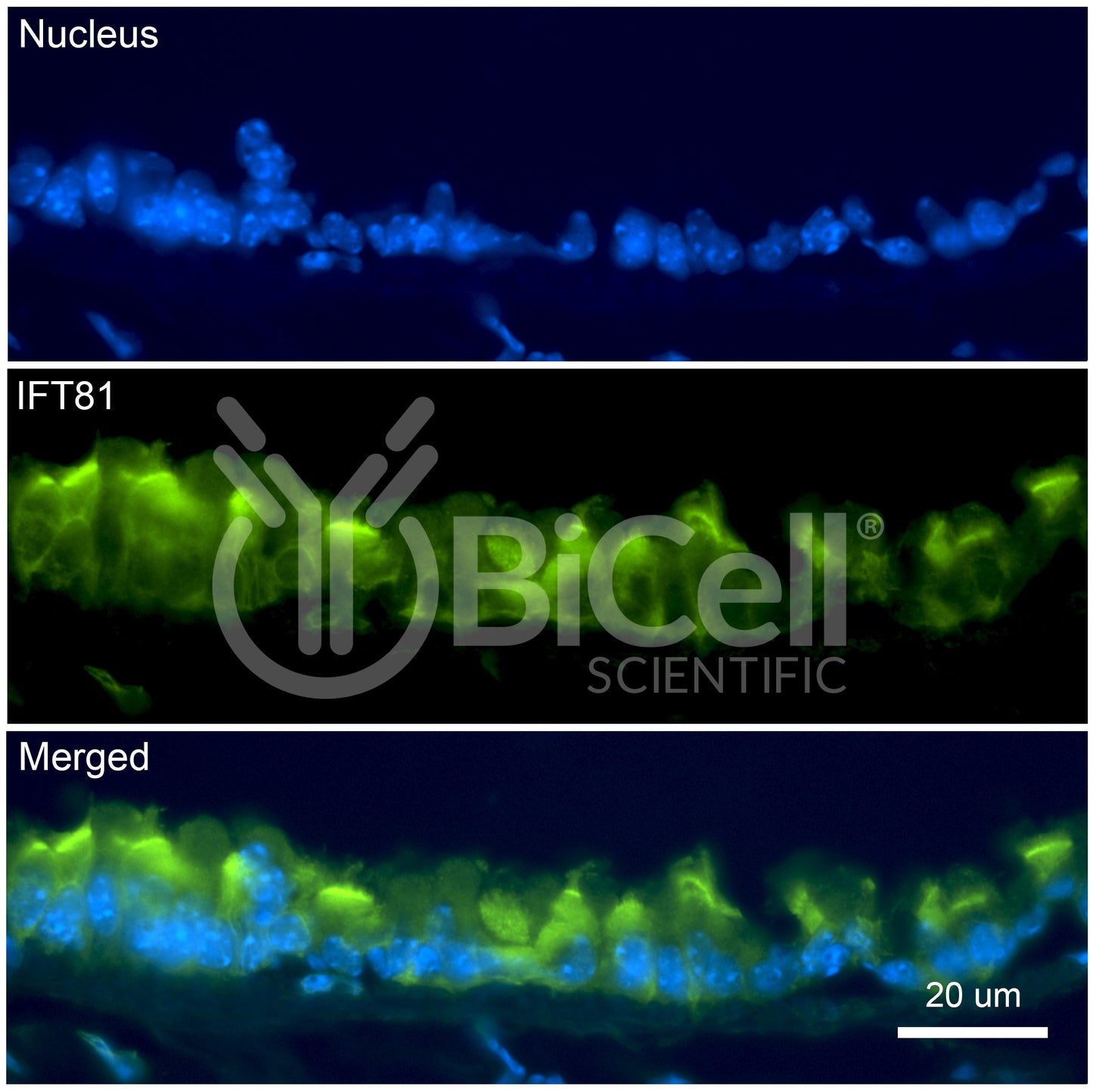 IFT81 Antibody