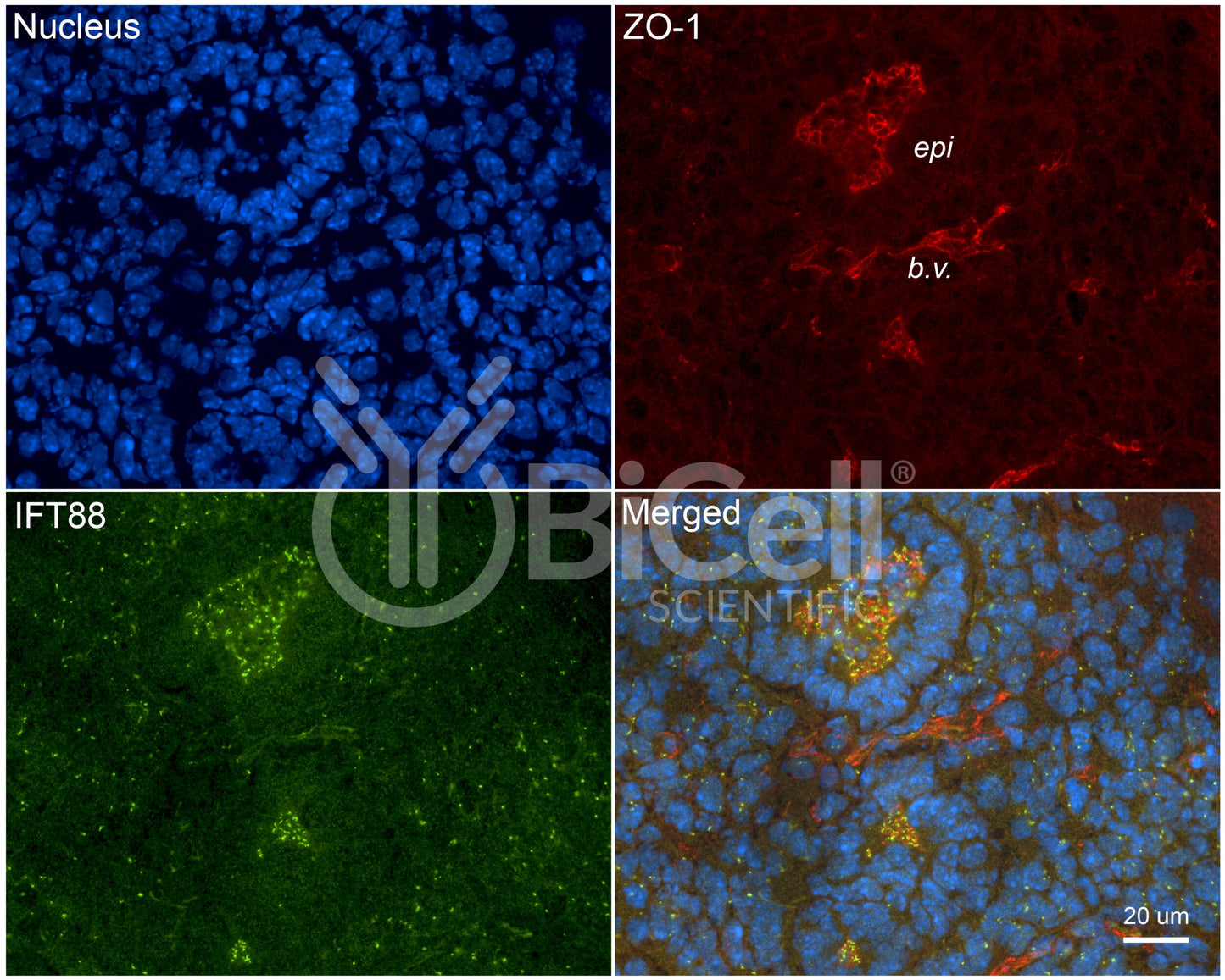 IFT88 Antibody - FFPE Validated