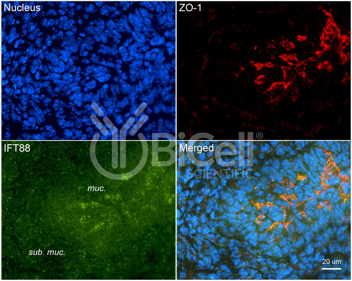 IFT88 Antibody - FFPE Validated