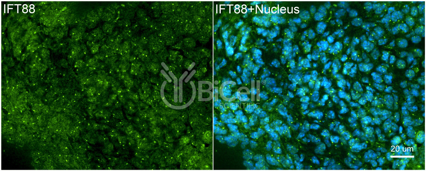 IFT88 Antibody - FFPE Validated