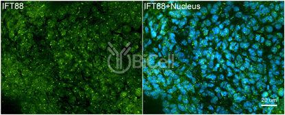 IFT88 Antibody - FFPE Validated