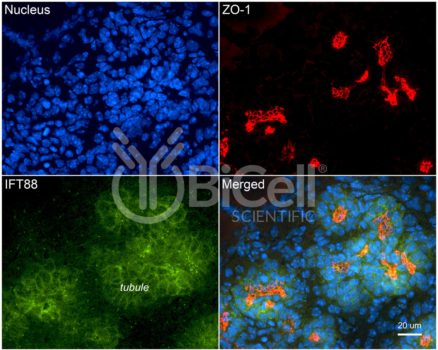 IFT88 Antibody - FFPE Validated