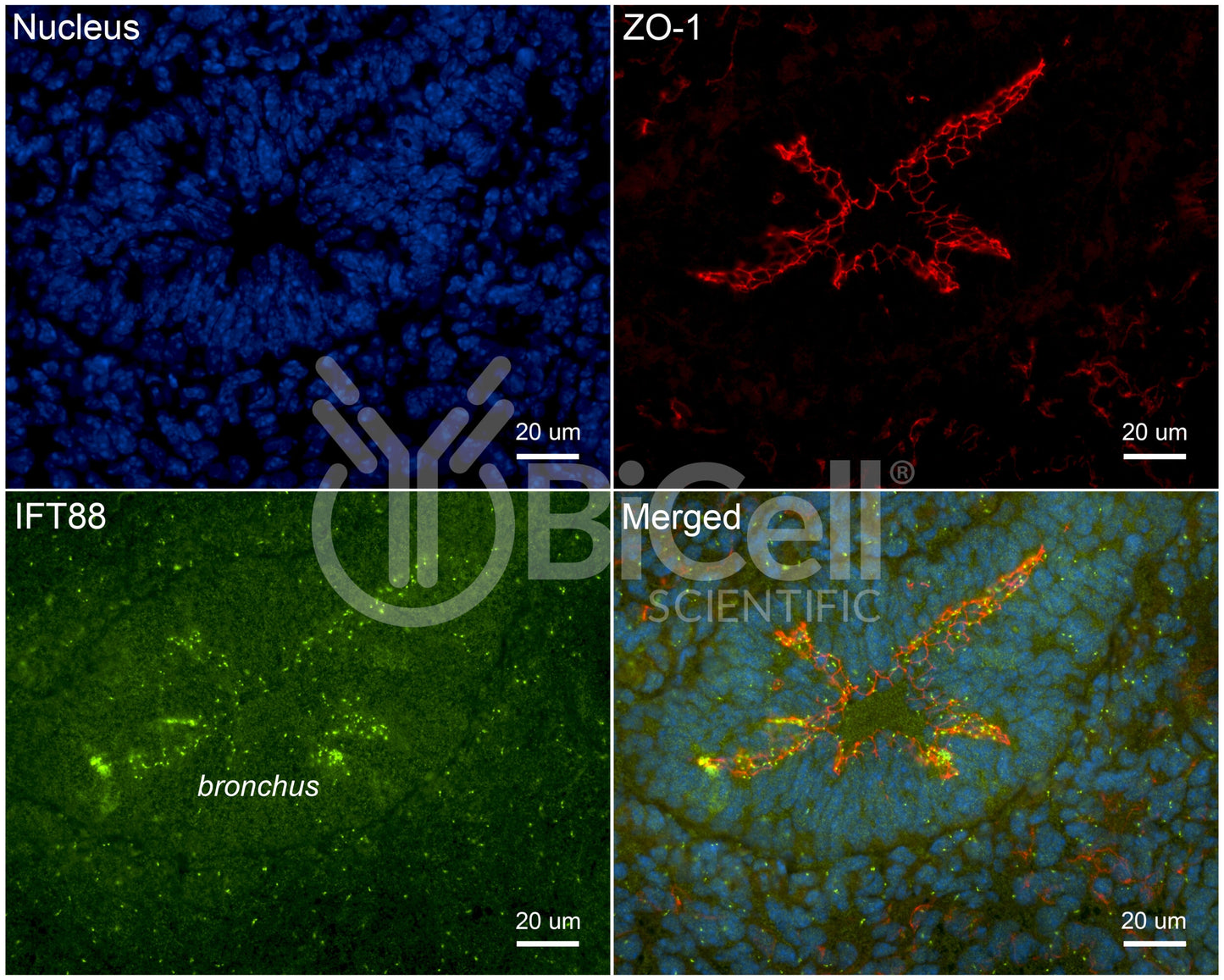 IFT88 Antibody - FFPE Validated