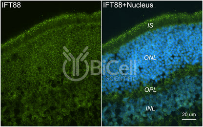 IFT88 Antibody - FFPE Validated