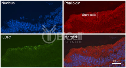 ILDR1 (Angulin-2) Antibody - Western Blot Validated
