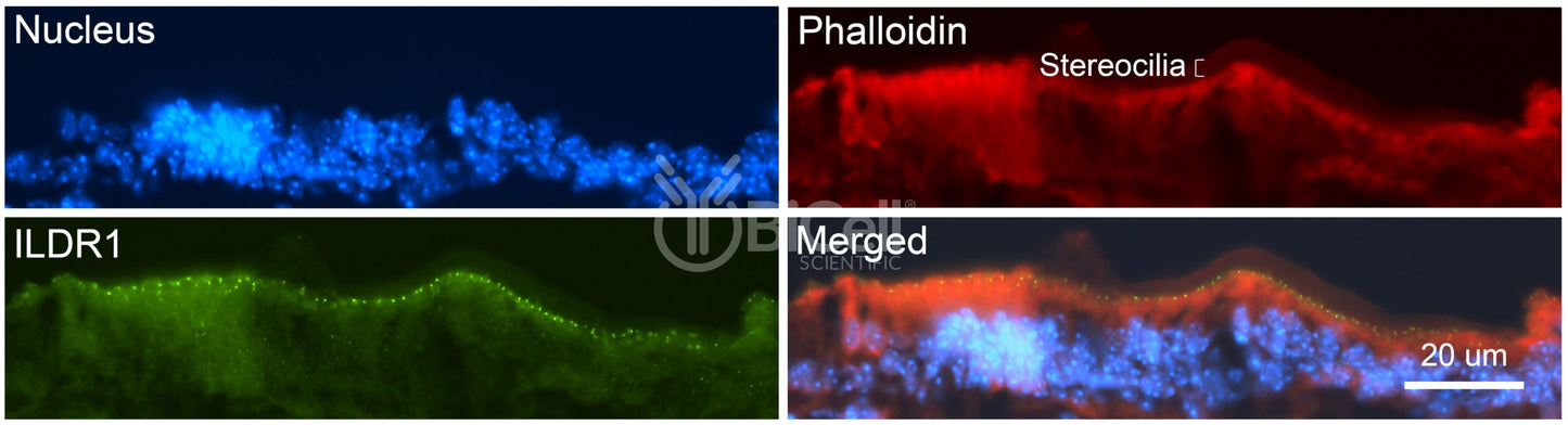 ILDR1 (Angulin-2) Antibody - Western Blot Validated