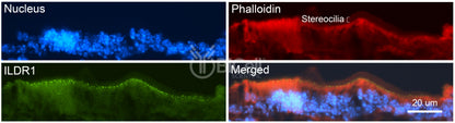 ILDR1 (Angulin-2) Antibody - Western Blot Validated