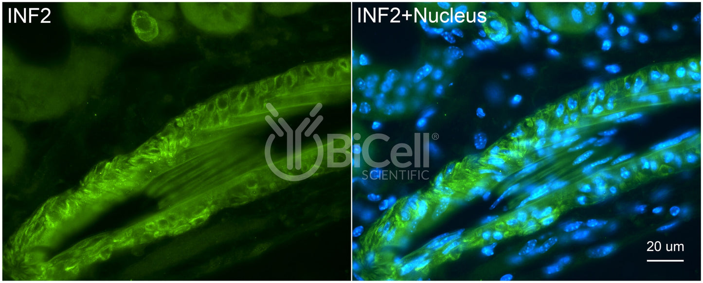 INF2 Antibody - FFPE Validated