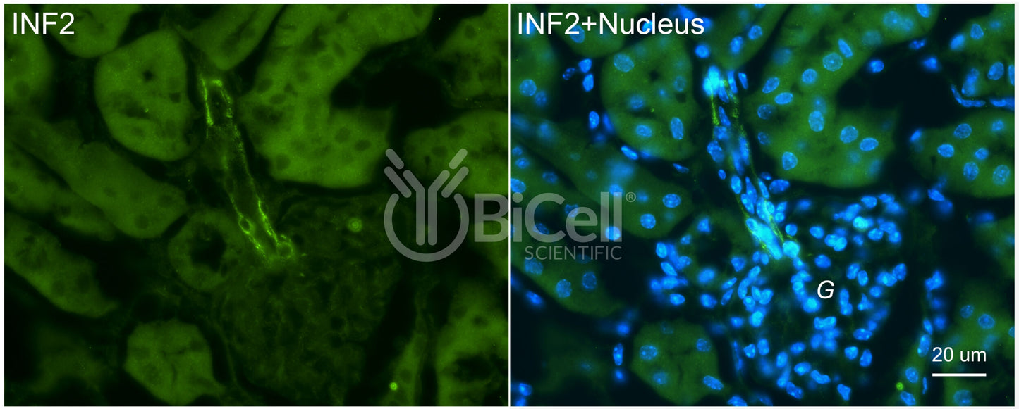 INF2 Antibody - FFPE Validated