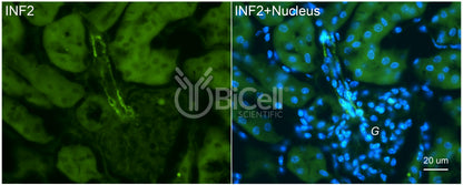 INF2 Antibody - FFPE Validated