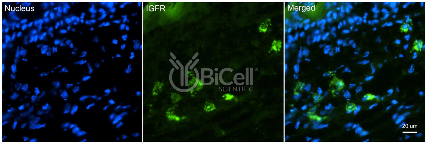 IGF1R (IGFR or CD221) Antibody - Western Blot Validated