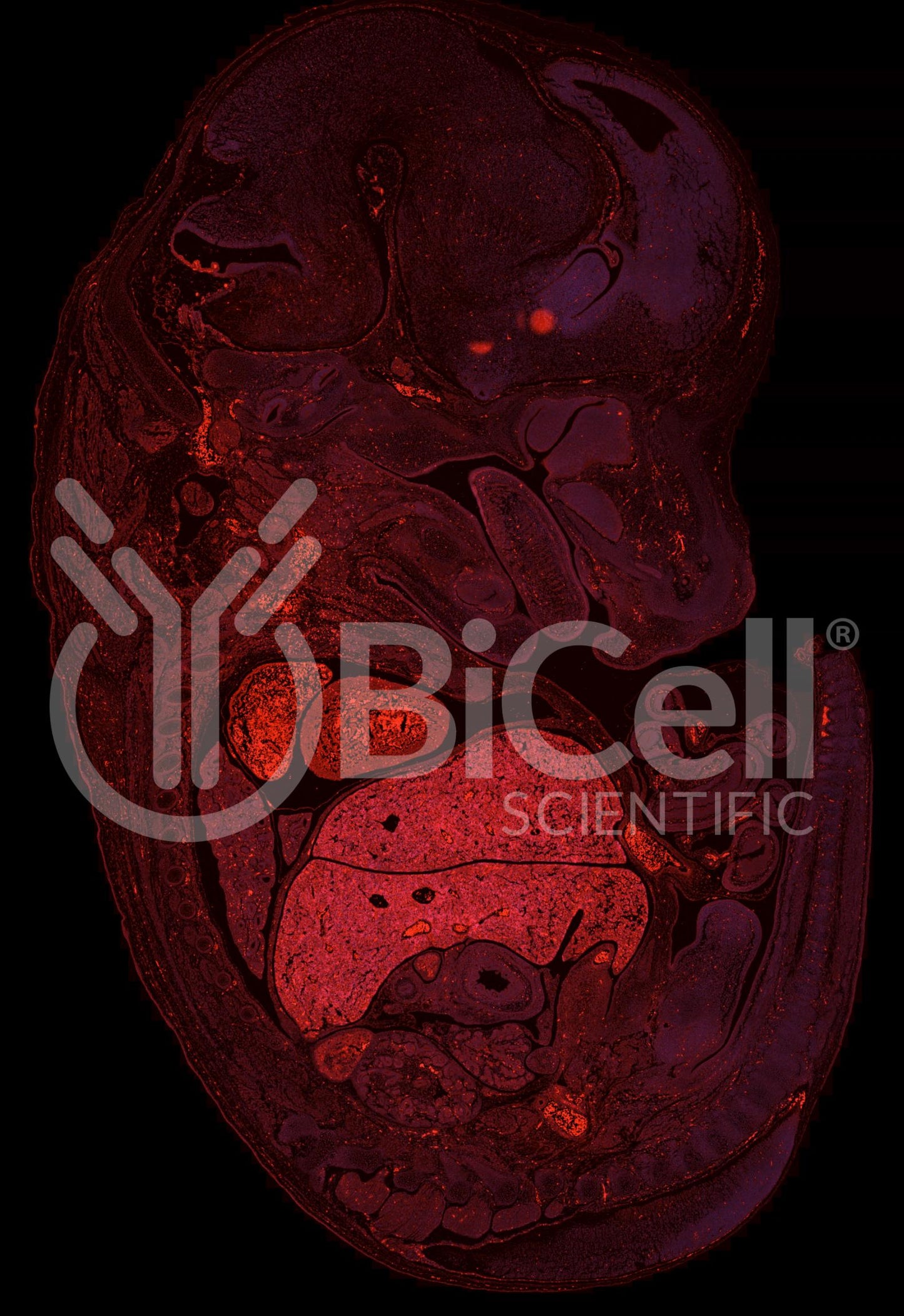 Integrin beta-4 (ITGB4 or CD104) Antibody - FFPE Validated