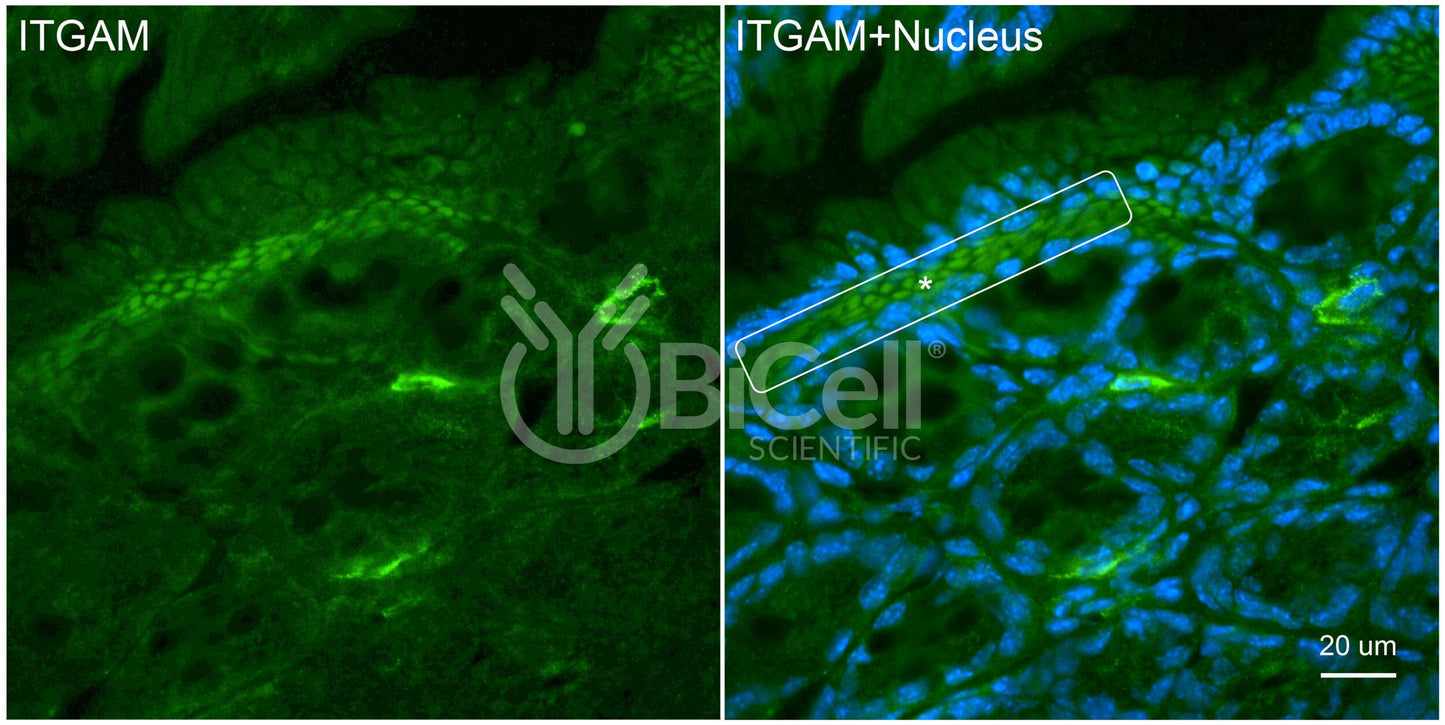 Integrin alpha-M (ITGAM or CD11b) Antibody - Western Blot Validated